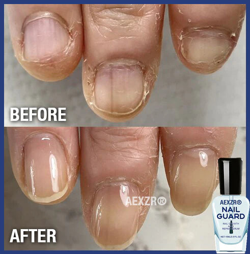 AEXZR® Repair Nail Serum