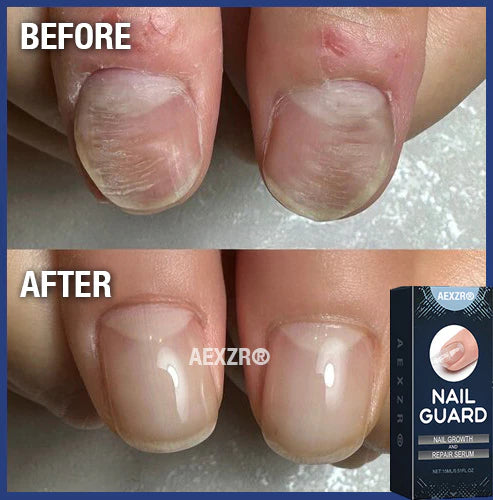 AEXZR® Repair Nail Serum