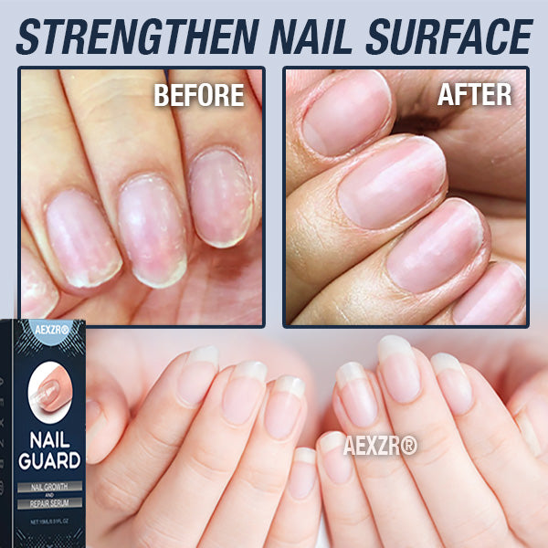 AEXZR® Repair Nail Serum